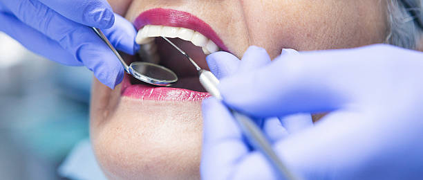 Best Emergency Wisdom Tooth Extraction in Mannford, OK